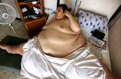 Pria Tergemuk Sedunia Berbobot 557 Kg Meninggal Dunia