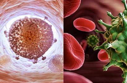 Pertama Kalinya Ditemukan Cara Hapus HIV Pada Manusia