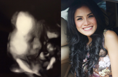 Nikita Mirzani Pamerkan Foto USG Anak Kedua