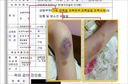 Bukti Foto-Foto yang Bisa Jebloskan Kim Hyun Joong ke Penjara