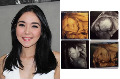 Gisella Anastasia Bahagia Hamil Anak Perempuan