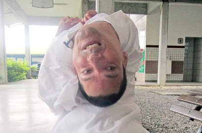 Kisah Kesuksesan Claudio Meski Lahir dengan Kepala Terbalik