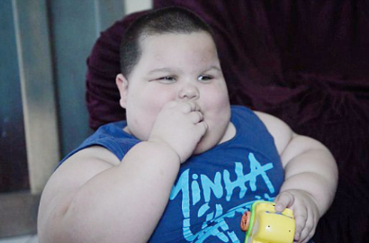 Bobot 70 Kg, Bocah Usia 3 Tahun Kena Sindrom Tak Bisa Berhenti Makan