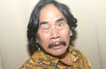 Jaja Mihardja Dilarikan ke Rumah Sakit dan Jalani Operasi