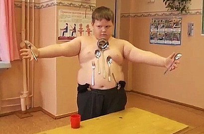 Tersengat Listrik, Badan Bocah Rusia Mendadak Jadi Magnet