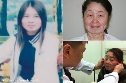 Wanita 28 Tahun Berubah Jadi Nenek-Nenek Setelah Melahirkan