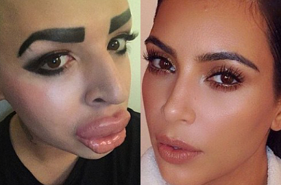 Demi Tampil Mirip Kim K, Pria di Inggris Rela Habis Miliaran Rupiah