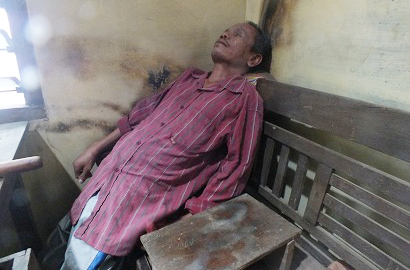 Penyakit Tubuh Kaku Serang Pria di Semarang Sejak 30 Tahun Lalu
