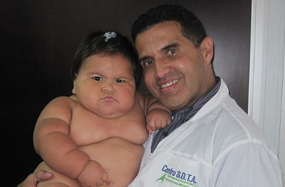 Astaga, Berat Bayi Usia 10 Bulan Asal Kolombia Mencapai 20 Kilogram