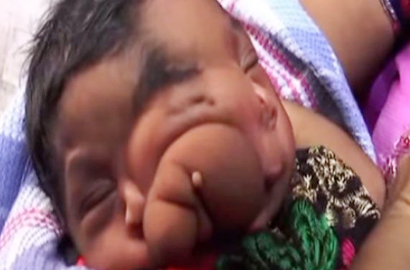 Lahir dengan Belalai, Bayi di India Dianggap Titisan Dewa Ganesha
