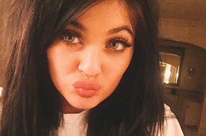 Heboh Tantangan Bibir Tebal, Fans Kylie Jenner Luka-Luka