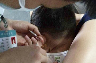 Telinga Bocah 4 Tahun di Tiongkok Distaples Gurunya Sendiri