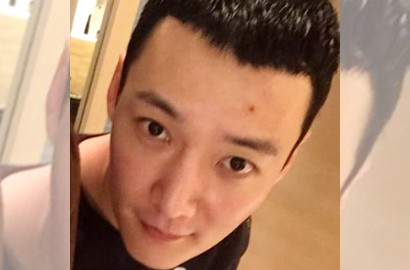 Aduh, Choi Jin Hyuk Alami Cedera Lutut Saat Wamil