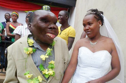 Pria 'Wajah Terburuk' di Uganda Jadi Ayah Anak Ke-8 dari Istri Ke-2