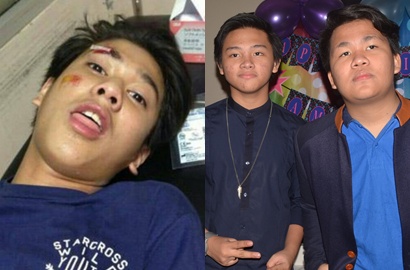 Iqbaal Kecelakaan, CJR Bakal Tampil Hanya Berdua?