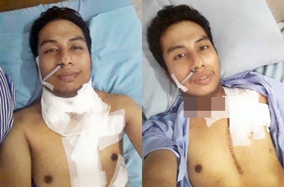 Netter Heboh Robby Mantan Perokok Meninggal Akibat Leher Berlubang