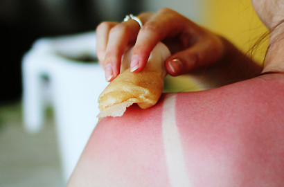 Heboh Seni Kulit Terbakar, Dermatolog Larang Ikuti Trend #Sunburnart
