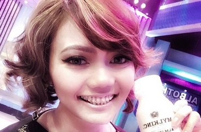 Mobil BMW Rina Nose Ditabrak Lari, Bagaimana Kondisinya?