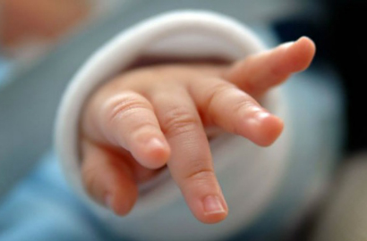 Bayi 3 Bulan Kehilangan Penglihatan Gara-Gara Kena Cahaya Flash Kamera