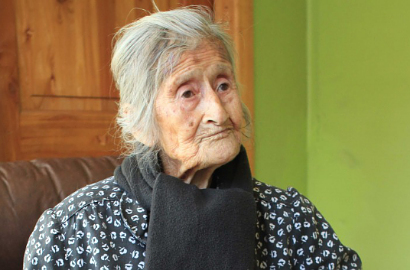 Nenek Usia 91 Tak Sadar di Rahimnya Ada Janin Selama 60 Tahun
