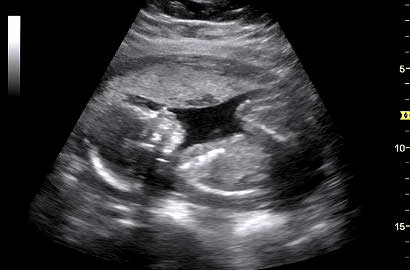 Hiii, Hasil USG 4D Ini Tunjukkan Wajah 'Bayi' yang Menyeramkan