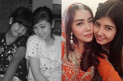 Ini Jawaban Bella Shofie Ditanya Bagian Mana Saja yang 'Dioplas'