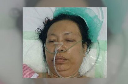 Gara-Gara Amnesia, Jemaah Haji Ini Hanya Ingat Satu Kata 'Indonesia'