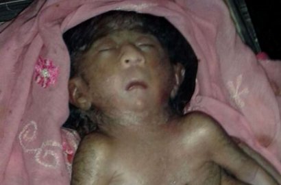 Lahir dengan 4 Tangan dan Kaki, Bocah Ini Disembah sebagai Reinkarnasi Ganesha