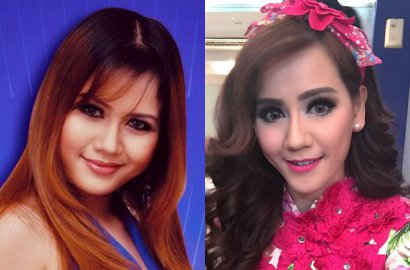 Operasi Plastik Rp 1 M, Pedangdut Nita Thalia Harus Sujud di Kaki Bapaknya