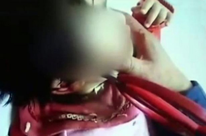 Ibu Siapkan Makan Siang, Balita Tancapkan Gunting di Kepala Sendiri