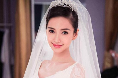 Buktikan Dirinya Tak Oplas, Ini Foto Angelababy Lakukan Pemeriksaan