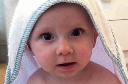 Punya Kelainan Jantung, Bayi Lucu Ini Selamat Berkat Organ Sapi