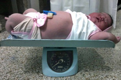 Hebat, Ibu Ini Melahirkan Bayi 'Raksasa' Seberat 6,7 Kilogram