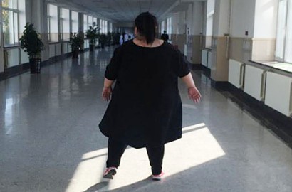 Lakukan Operasi Bypass, Wanita Ini Berharap Dapat Turunkan 240 Kg Beratnya