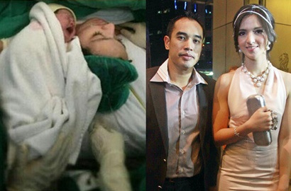 Bayi Nia Ramadhani dan Ardi Bakrie Masuk ICU
