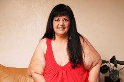 Berkat Putus, Wanita Ini Berhasil Turunkan Berat Badan 107 Kg