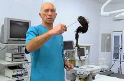 Astaga, Ada Rambut Seberat 1 Kg di Perut Gadis Ini