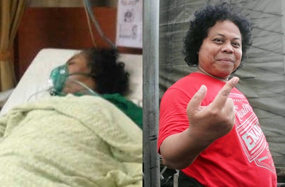 Kondisi Kritis, Penyakit Budi Anduk Masih Dirahasiakan untuk Publik