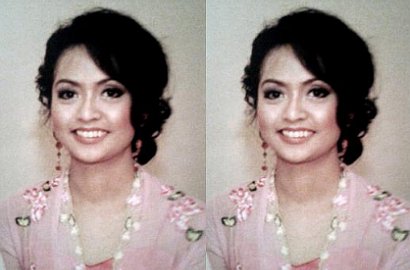 Gandeng FBI, Polisi Minta dr Randall yang Tangani Siska Ditindak di AS