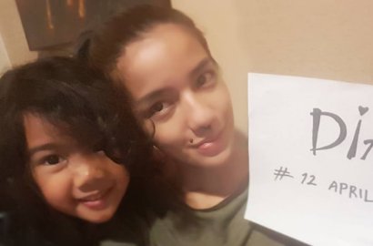Sedihnya Putri Sheila Marcia Terkena Cacar Air