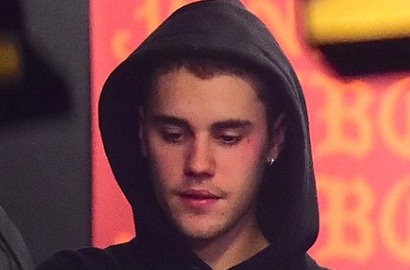 Wajah Bengkak Karena Tato Wajah, Justin Bieber Malah Dihujat Netizen