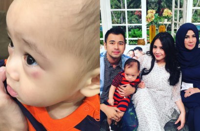Wajah Rafathar Memar Gara-Gara Jatuh, Ini Kata Nagita dan Ibu Raffi Ahmad