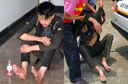 Nge-Game Tanpa Henti Selama 6 Hari, Kaki Remaja Asal Tiongkok Membusuk