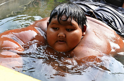 Berbobot 192 Kg, Bocah Usia 10 Tahun Asal Indonesia Jadi Sorotan Dunia