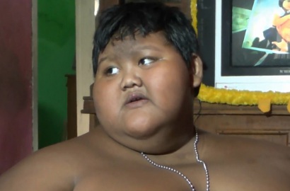 Diet Ketat, Bobot Arya Bocah Obesitas Turun Jadi 188,4 Kg dalam Sehari