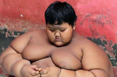 Ingin Masuk Sekolah, Arya Bocah Obesitas Tuntut Orangtuanya Rp 1 M