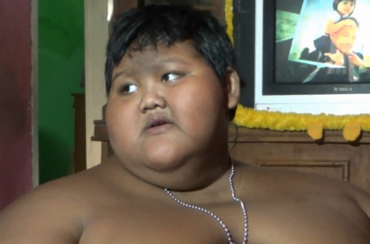 Terpeleset, Arya Bocah Obesitas Akhirnya Batal Masuk Sekolah
