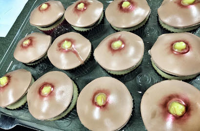 Cupcakes Ini Punya Bentuk Jerawat Siap Pencet, Berani Cicip?