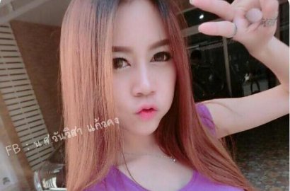 Wow, Wajah Gadis Thailand Ini Berubah Drastis Usai Operasi Plastik