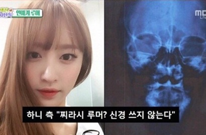 Tetap Dituduh Oplas Meski Tunjukkan CT Scan, Hani EXID Dibela Kwanghee
